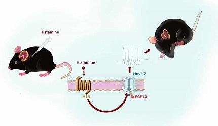 成纖維細(xì)胞生長(zhǎng)因子FGF13在癢覺中的作用及其機(jī)制